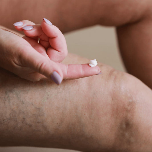 Vein Smoothing Varicose Veins Cream. Shop Skin Care on Mounteen. Worldwide shipping available.
